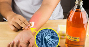 10 phương pháp hữu hiệu điều trị các bệnh về da thường gặp