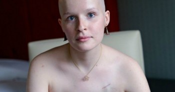 Những điều 'khó nói' của những bệnh nhân ung thư phải cắt bỏ ngực để điều trị bệnh

