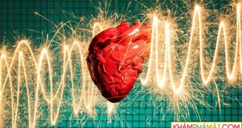 Điều gì xảy ra trong cơ thể khi bạn bị đau tim?