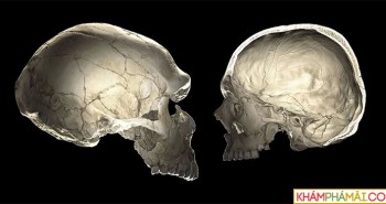 Những người đầu hơi bẹp là do gene di truyền của người Neanderthal