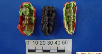 Phát hiện “kẹo cao su cổ đại” 8.000 năm tuổi