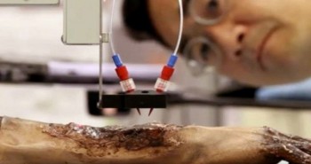 Máy in 3D sinh học in da trực tiếp lên vết thương