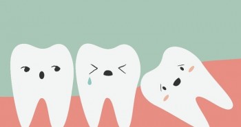 Loại bỏ suy nghĩ sai lầm về việc nhổ răng khôn