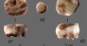 Dù không ăn đường, uống nước có ga nhưng người cổ đại vẫn bị sâu răng?