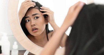 Tại sao căng thẳng lại gây rụng tóc?