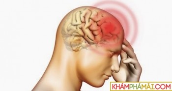 Ung thư não, triệu chứng và dấu hiệu nhận biết