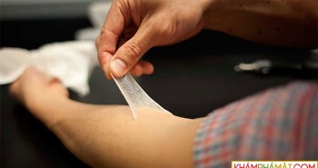 Nga chế tạo vải "da nhân tạo" để băng vết thương