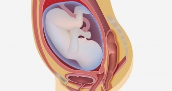 Cẩn trọng với viêm màng ối khi mang thai