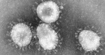 Công bố hình ảnh đầu tiên về virus Corona